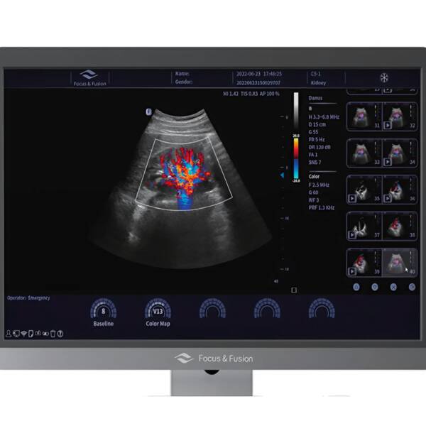 Ультразвукова діагностична система стаціонарна середнього класу Danus 8 Focus & Fusion, рис. 5