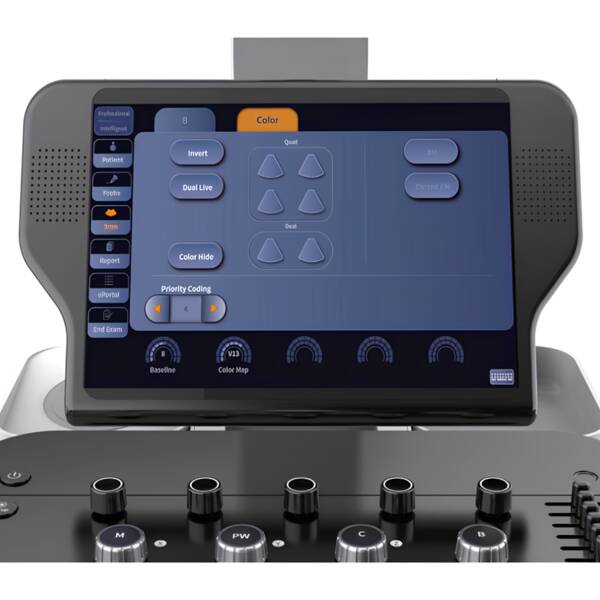 Ультразвукова діагностична система стаціонарна середнього класу Danus 8 Focus & Fusion, рис. 3