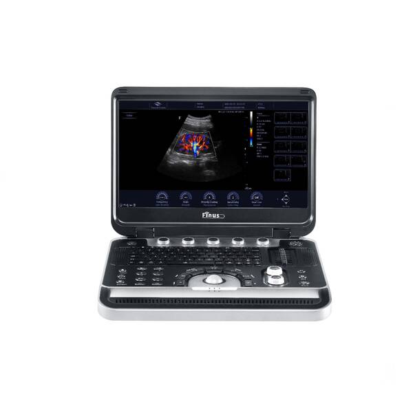 Ультразвукова діагностична система портативна Finus 45 Focus & Fusion, рис. 1