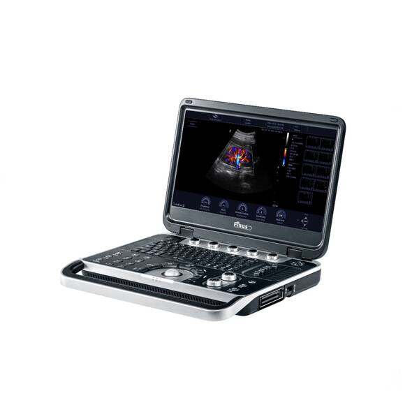 Ультразвукова діагностична система портативна Finus 45 Focus & Fusion, рис. 3