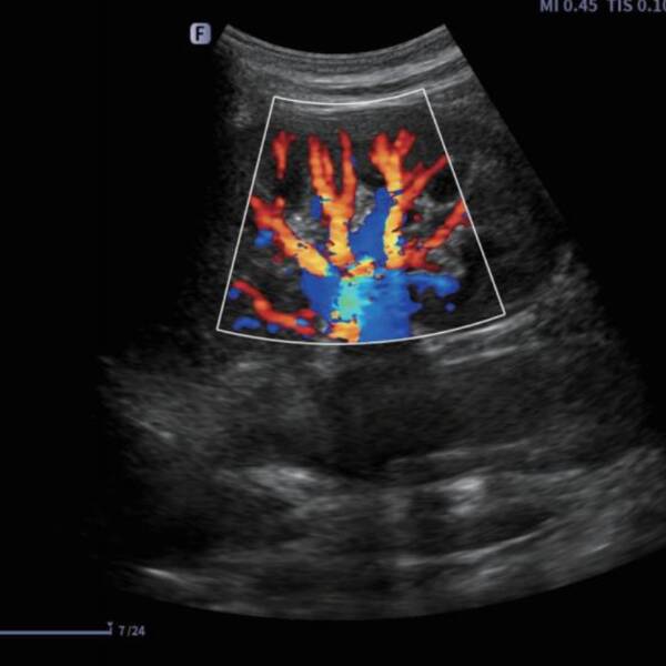 Ультразвукова діагностична система портативна Finus 45 Focus & Fusion, рис. 5