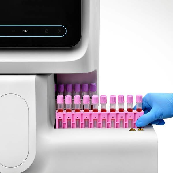 Аналізатор автоматичний гематологічний ВС-7600 Mindray, рис. 5