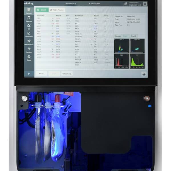 Аналізатор автоматичний гематологічний ВС-7800 Mindray, рис. 5