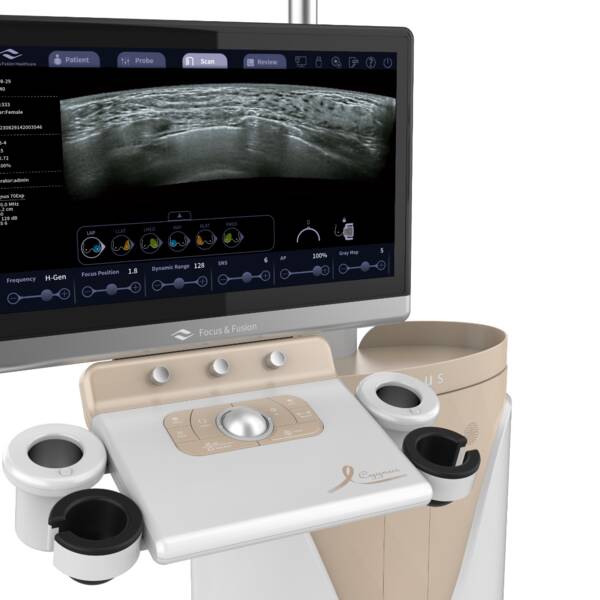  Автоматизована 3D-система ультразвукової діагностики молочних залоз Cygnus 70 Focus & Fusion, рис. 2