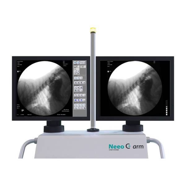 Neeo C-Arm R9 Мобільна цифрова рентгенографічна система С-дуга Ibis, рис. 6