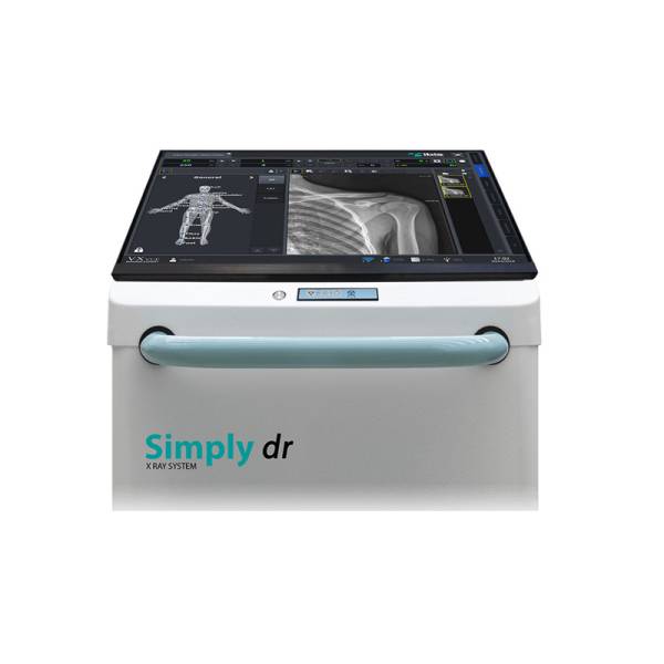 Simply dr Мобільна рентгенографічна система Ibis, рис. 2