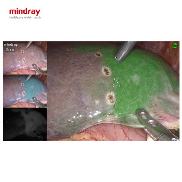 UX5 4K 2D NIR Лапароскопічна стійка Mindray, рис. 2