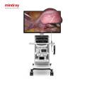UX5 4K 3D WL Лапароскопічна стійка Mindray, прев. 0