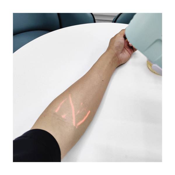 Веношукач портативний Konted KT-10, рис. 7