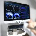 Томограф электроимпедансный EIT600 Amoul, прев. 1