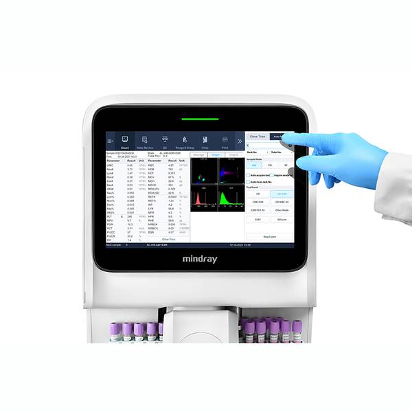 Аналізатор гематологічний автоматичний BC-760, Mindray, рис. 5