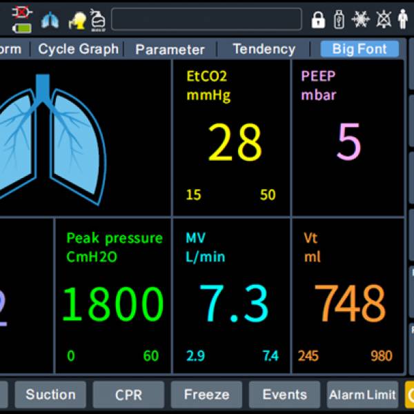 Апарат ШВЛ Т6 Advanced Model Amoul, рис. 5