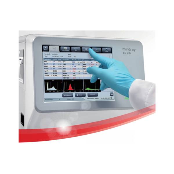 Аналізатор гематологічний автоматичний BC-20s Mindray, рис. 1