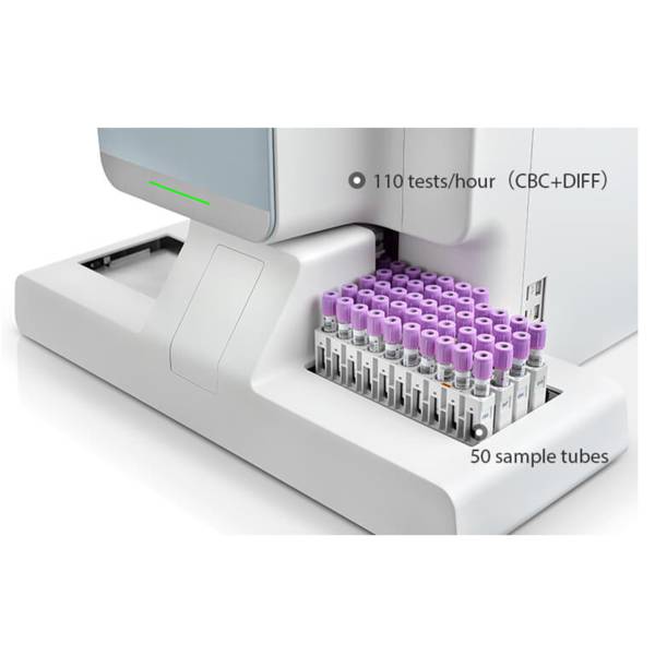 Аналізатор гематологічний автоматичний ВС-6000 Mindray, рис. 2