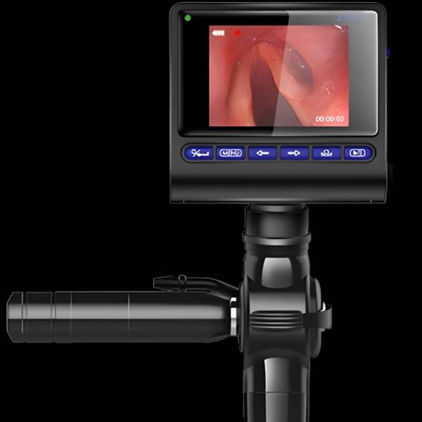 Відеоларингоскоп гнучкий портативний МВС-4 AOHUA ENDOSCOPE, рис. 2
