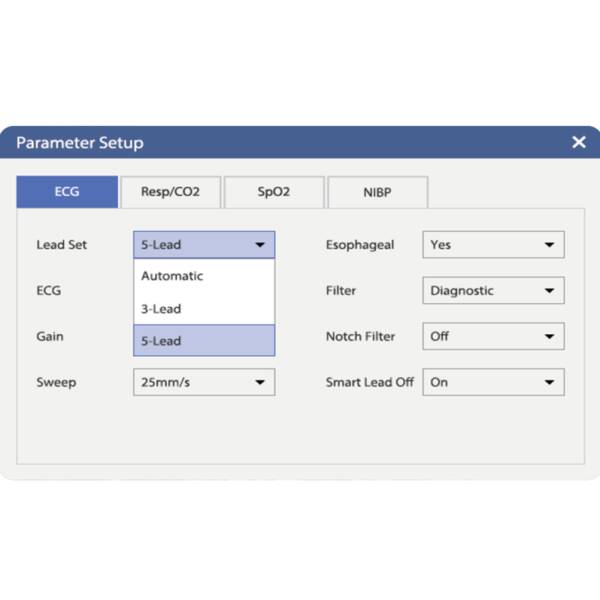Монітор пацієнта ветеринарний Vetal 3 (CO₂) Mindray Animal, рис. 5