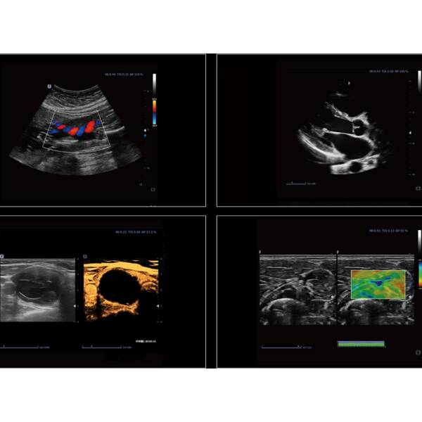Система стаціонарна ультразвукова експертного класу +2 датчики Cetus 40 Focus & Fusion, рис. 4