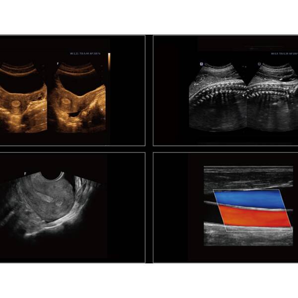 Система стаціонарна ультразвукова експертного класу +2 датчики Cetus 40 Focus & Fusion, рис. 5