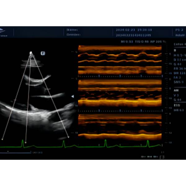 Система стаціонарна ультразвукова експертного класу +2 датчики Cetus 40 Focus & Fusion, рис. 6