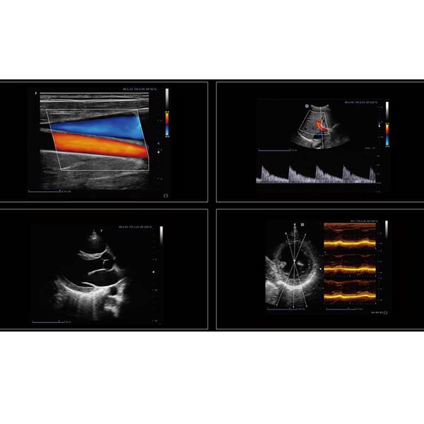 Ультразвукова діагностична система портативна експертного класу +2 датчики Finus 70 Focus & Fusion, рис. 3