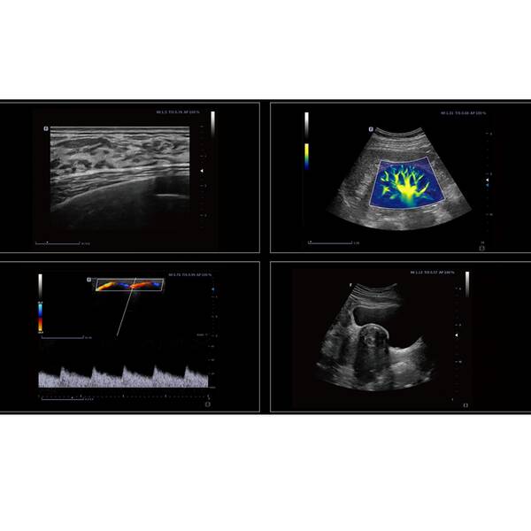 Ультразвукова діагностична система портативна експертного класу +2 датчики Finus 70 Focus & Fusion, рис. 4