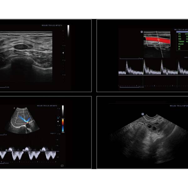 Ультразвукова діагностична система стаціонарна високого класу +2 датчики Danus 30 Focus & Fusion, рис. 5