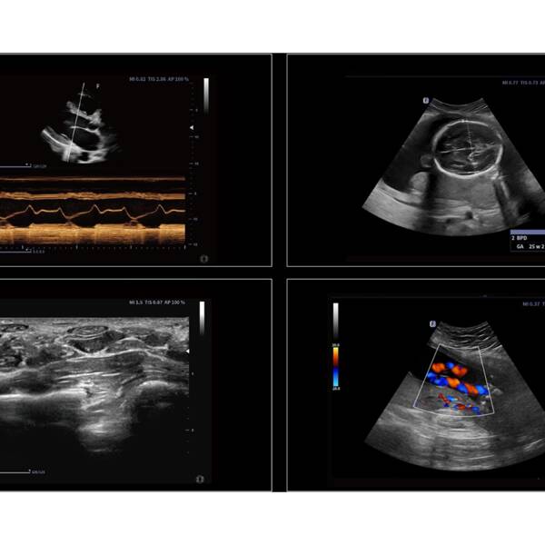 Ультразвукова діагностична система стаціонарна високого класу +2 датчики Danus 30 Focus & Fusion, рис. 4