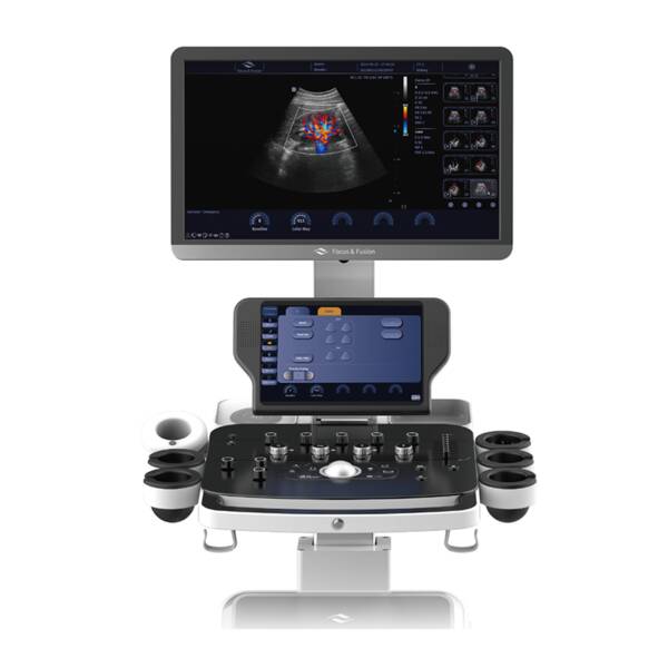 Ультразвукова діагностична система стаціонарна високого класу +2 датчики Danus 10 Focus & Fusion, рис. 2