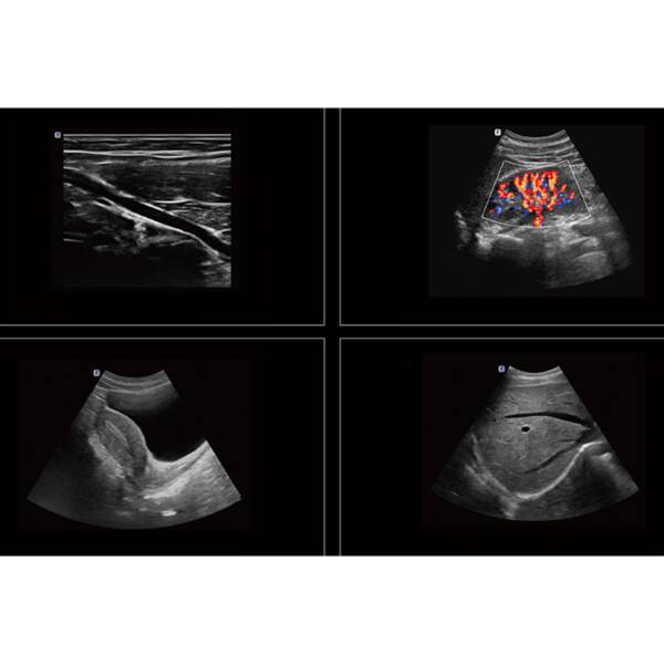 Ультразвукова діагностична система стаціонарна високого класу +2 датчики Danus 10 Focus & Fusion, рис. 8