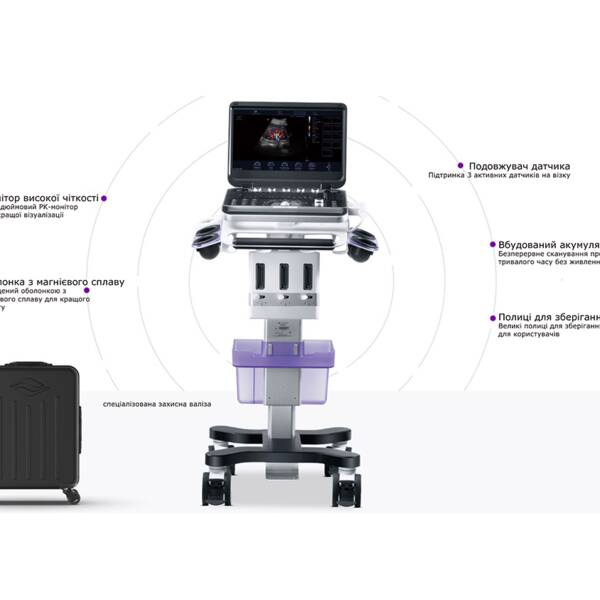 Ультразвукова діагностична система портативна високого класу +2 датчики Finus 50 Focus & Fusion, рис. 3