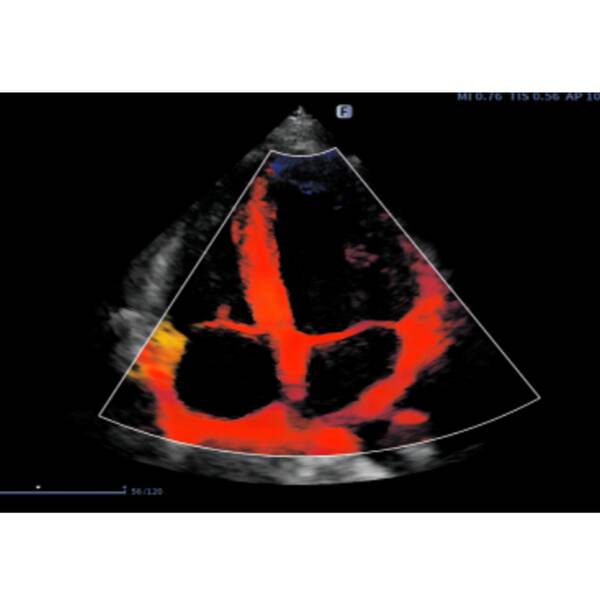 Ультразвукова діагностична система портативна високого класу +2 датчики Finus 50 Focus & Fusion, рис. 7