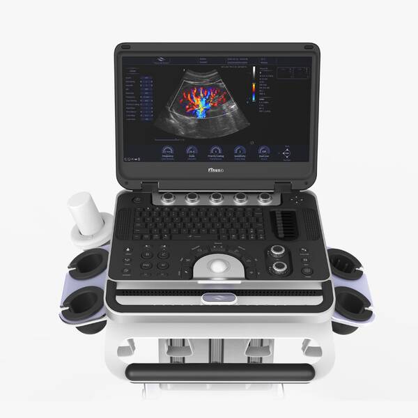 Ультразвукова діагностична система портативна високого класу +2 датчики Finus 50 Focus & Fusion, рис. 1