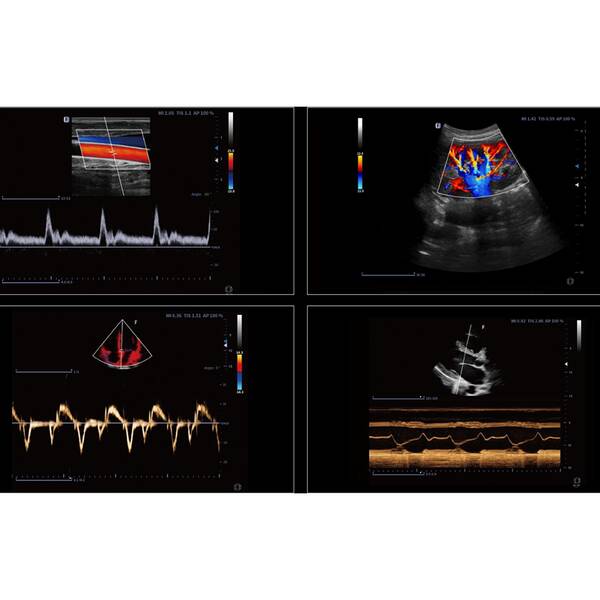 Ультразвукова діагностична система портативна високого класу +2 датчики Finus 50 Focus & Fusion, рис. 4