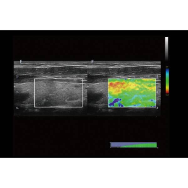 Ультразвукова діагностична система портативна високого класу +2 датчики Finus 50 Focus & Fusion, рис. 5