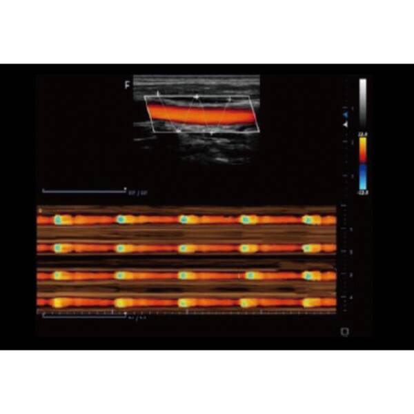 Ультразвукова діагностична система портативна високого класу +2 датчики Finus 50 Focus & Fusion, рис. 6
