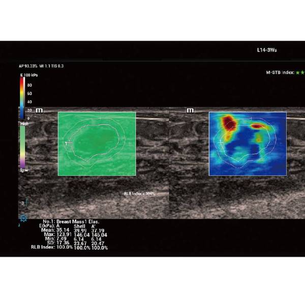 Vetus 9 Premium УЗД апарат для тварин Mindray Animal, рис. 17