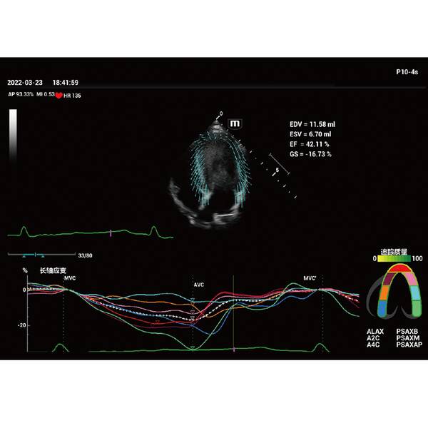 Vetus 9 Premium УЗД апарат для тварин Mindray Animal, рис. 5