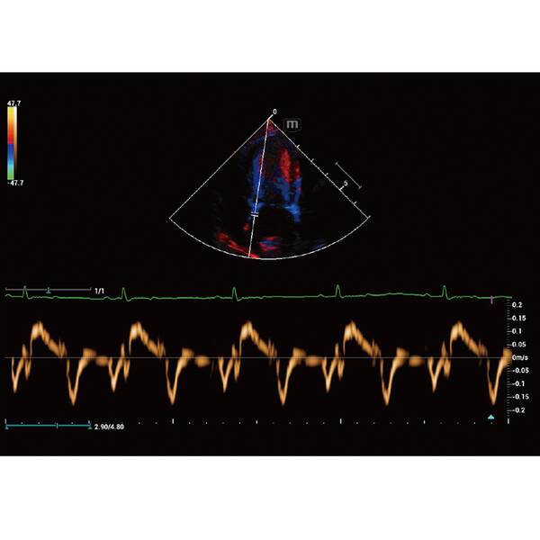 Vetus 9 Premium УЗД апарат для тварин Mindray Animal, рис. 6