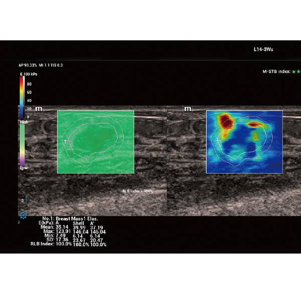 Vetus 9 Premium УЗД апарат для тварин Mindray Animal, рис. 3