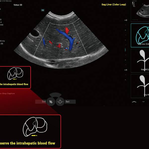 Vetus 50 УЗД апарат для тварин Mindray Animal, рис. 6