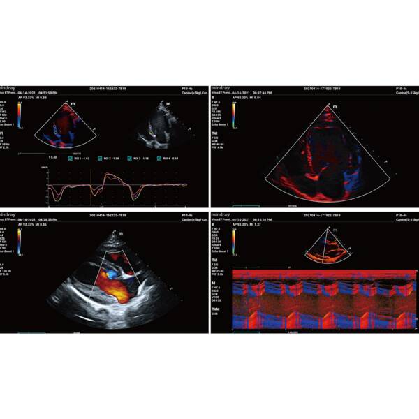 Vetus E7 Premium (with U-Bank) УЗД апарат для тварин Mindray Animal , рис. 10