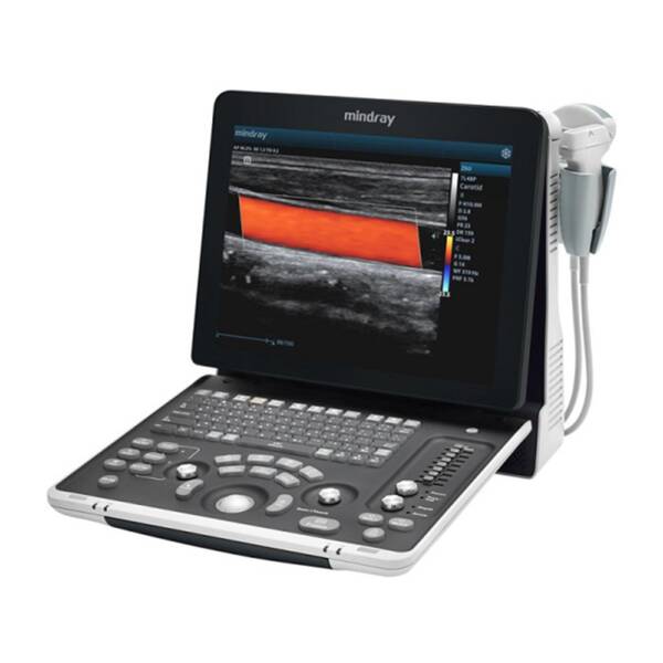 Z60 Vet Advanced (iPower) УЗД апарат для тварин Mindray Animal, рис. 3