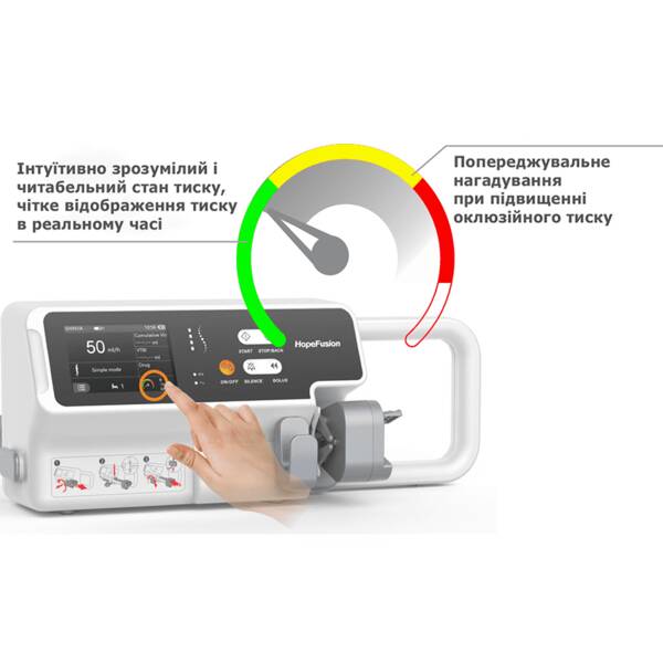 Шприцевий насос SP5 BYOND, рис. 1